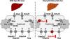 Altered Expression and Function of Hepatic Transporters in a Rodent Model of Polycystic Kidney Disease